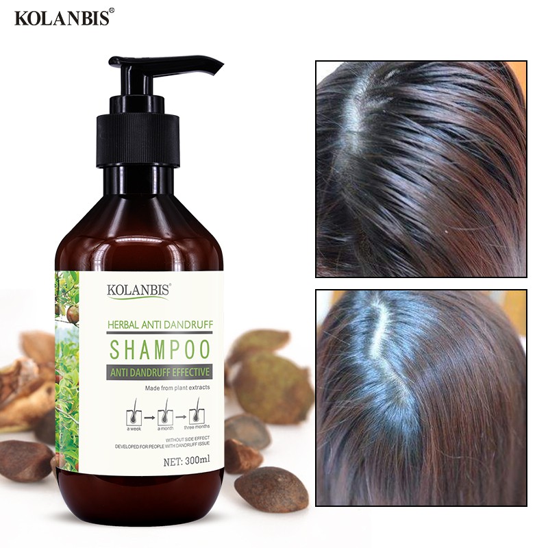 Oily Hair Shampoo Reduce Hair Fall Anti Itch Cure Oily Scalp Hair