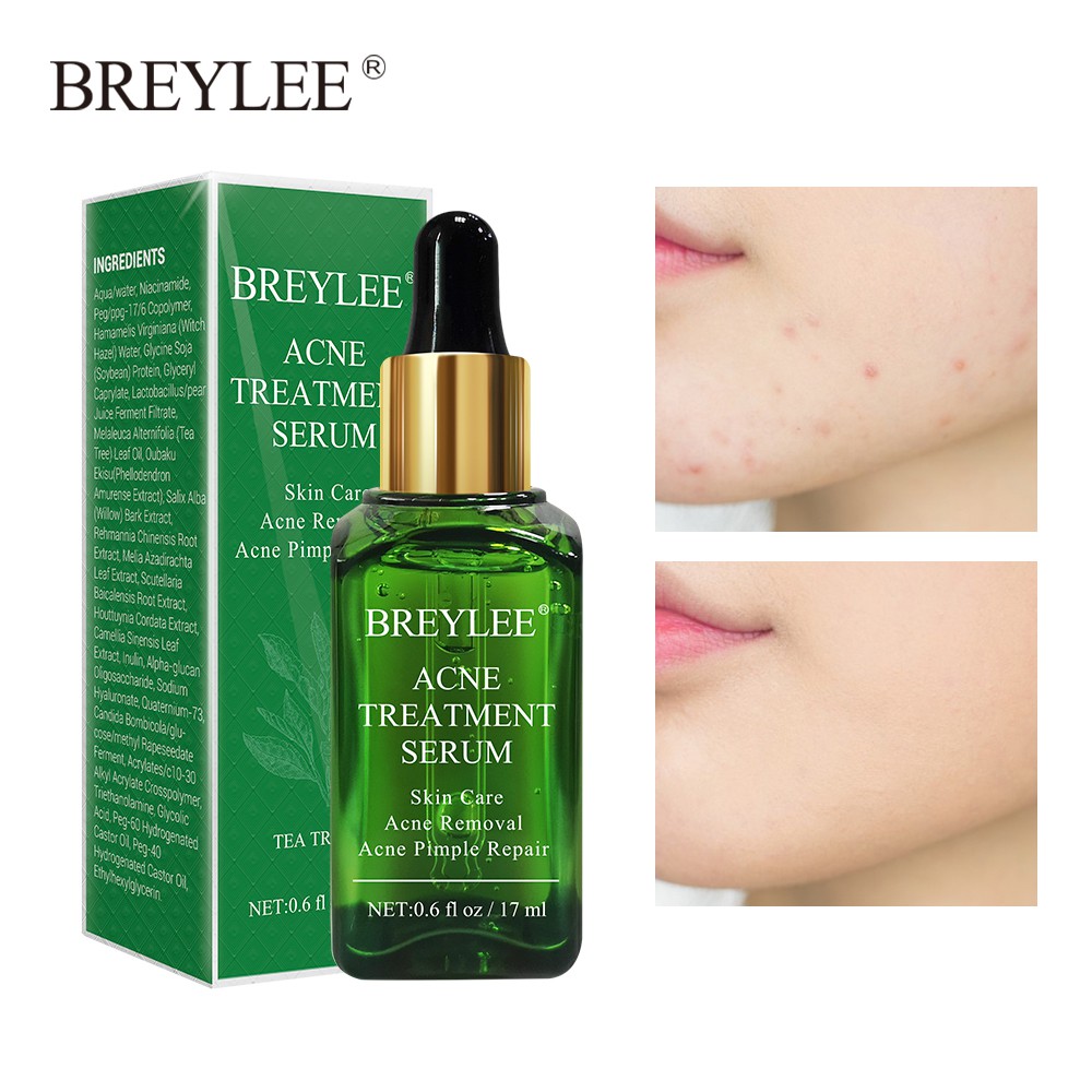 BREYLEE Acne Treatment Serum | Shopee Malaysia