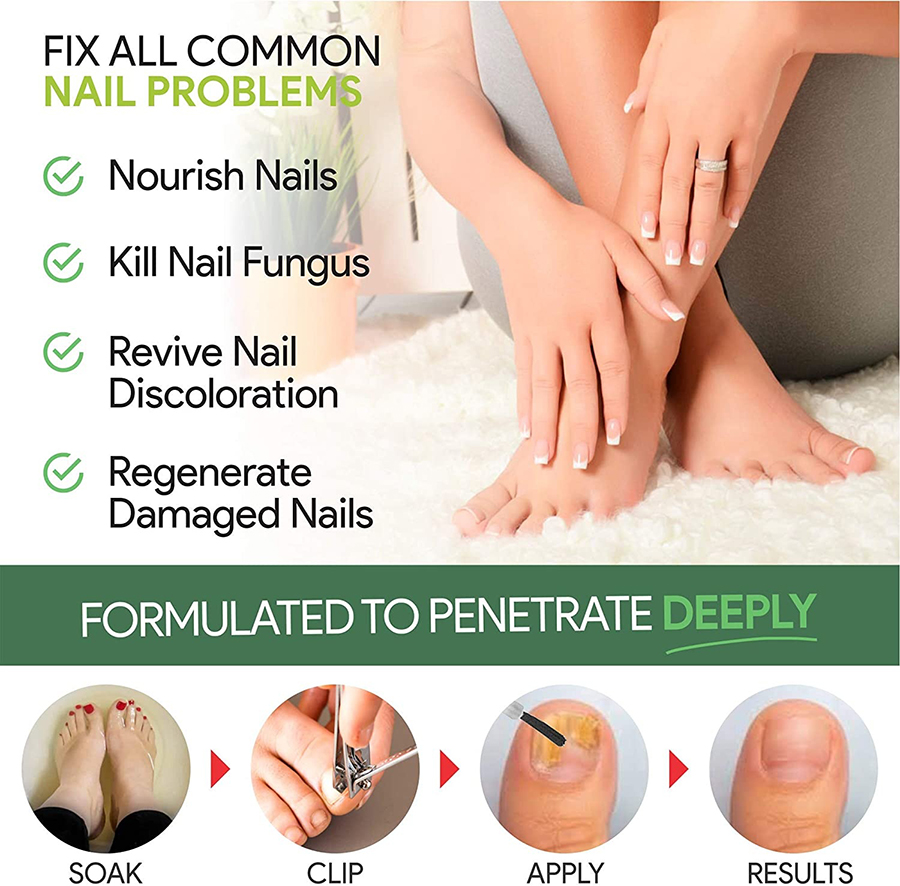 Essential Multi Get Healthy Fungus-Free Nails Our Extra-Strength Treatment: Repair Protect Prevent Fungal Infections - Image 4