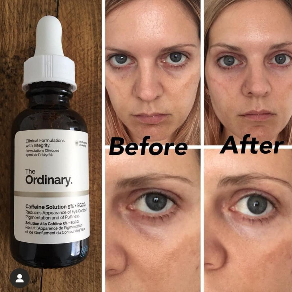 the ordinary caffeine eye serum