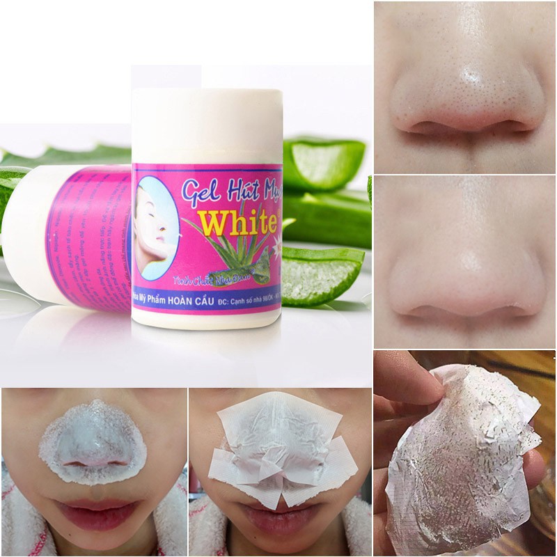 22g Aloe Vera Remove Blackheads Acne Shrink Pores Nose Paste | Shopee ...