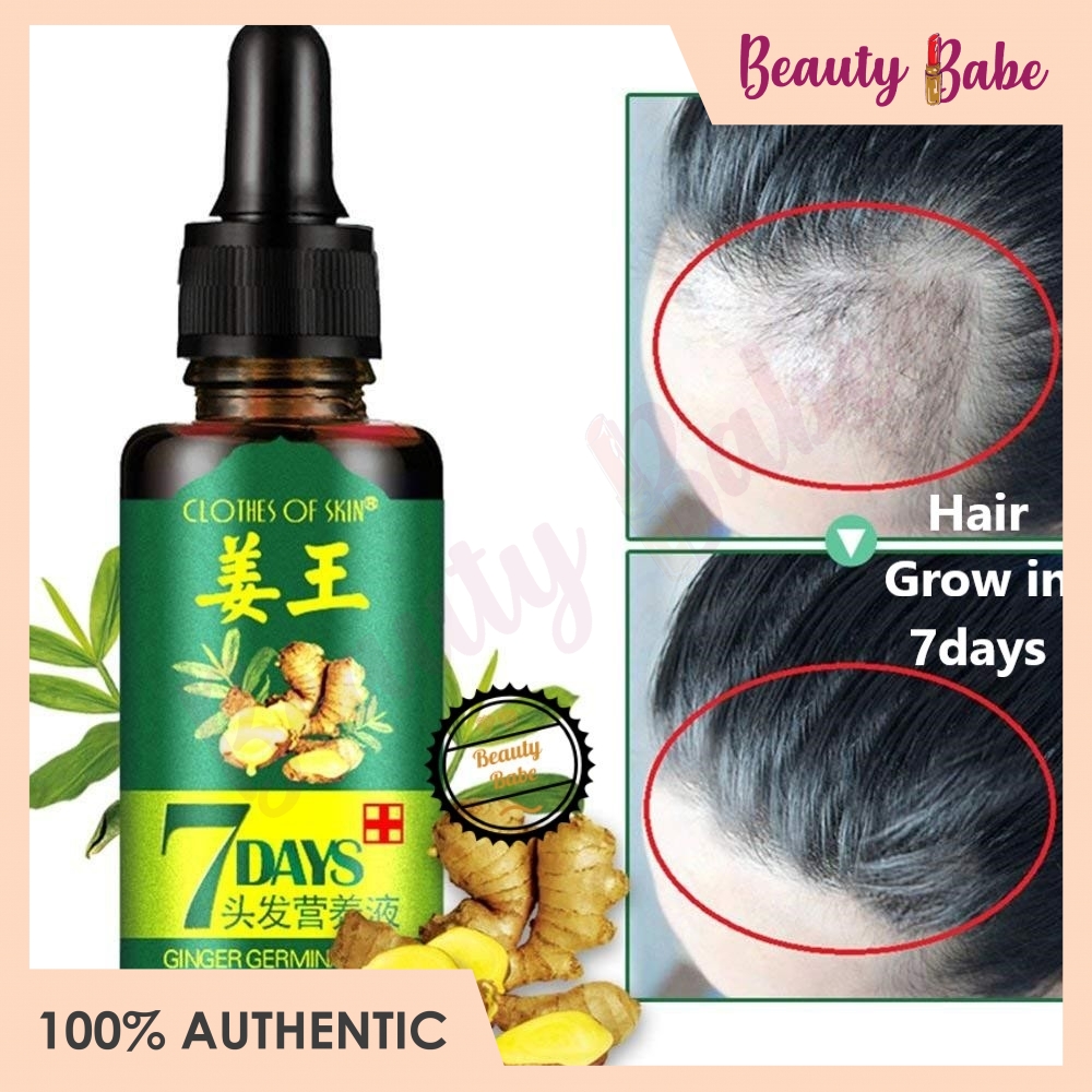 Ginger King Germinal Oil Ginger Hair Growth Essence Hair Growth Serum ...