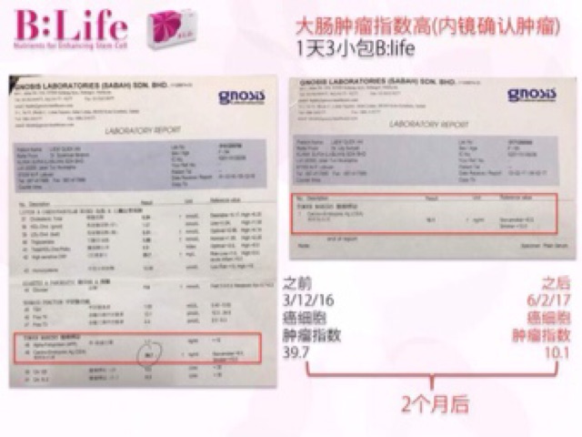 B Life Stem Cell Enhancer Shopee Malaysia