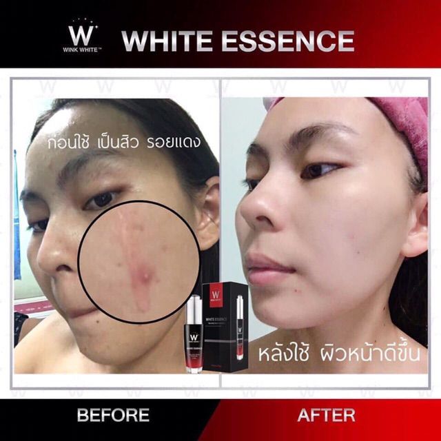 Wink White White Essence Shopee Malaysia