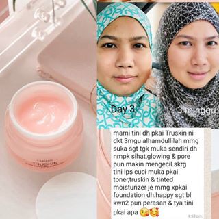 truskin moisturiser