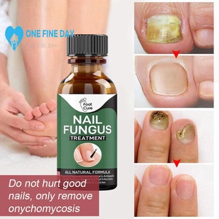 Nail Repair Liquid Hand and Foot Onychomycosis Care Antibacterial Thickening Repair P7G1