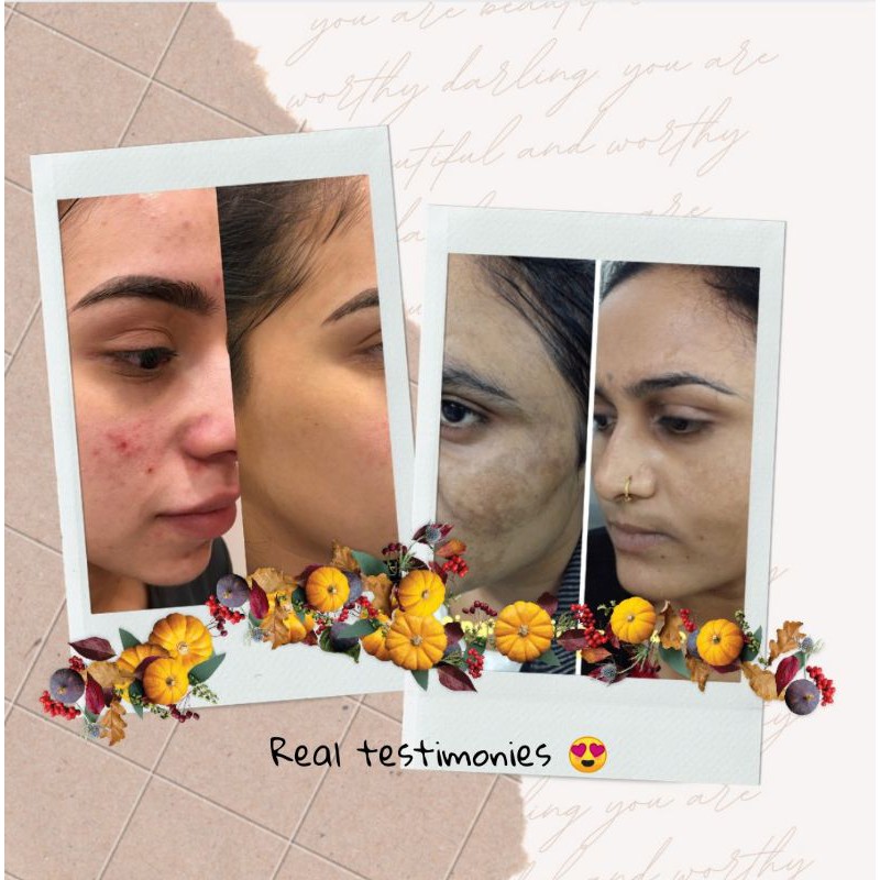 shine potion skincare