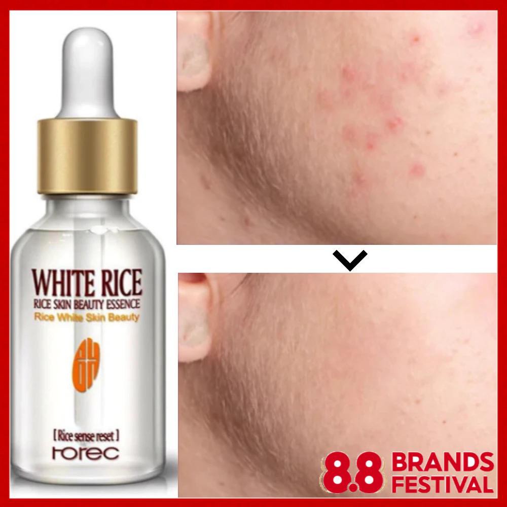 [ READY STOCK ] 100 ORIGINAL ROREC WHITE RICE SKIN BEAUTY ESSENCE