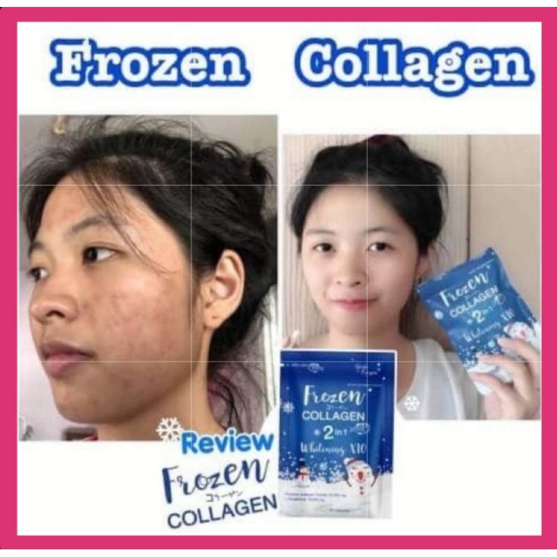 Ready Stock 60biji Original Frozen Collagen 2in1 Whitening Pemutih Muka Kulit Dan Badan Beauty And Health