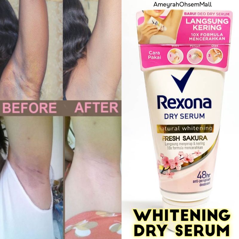 Krim Pemutih Ketiak Paha Dkt Miss V Buttock Armpit Whitening Shopee Malaysia