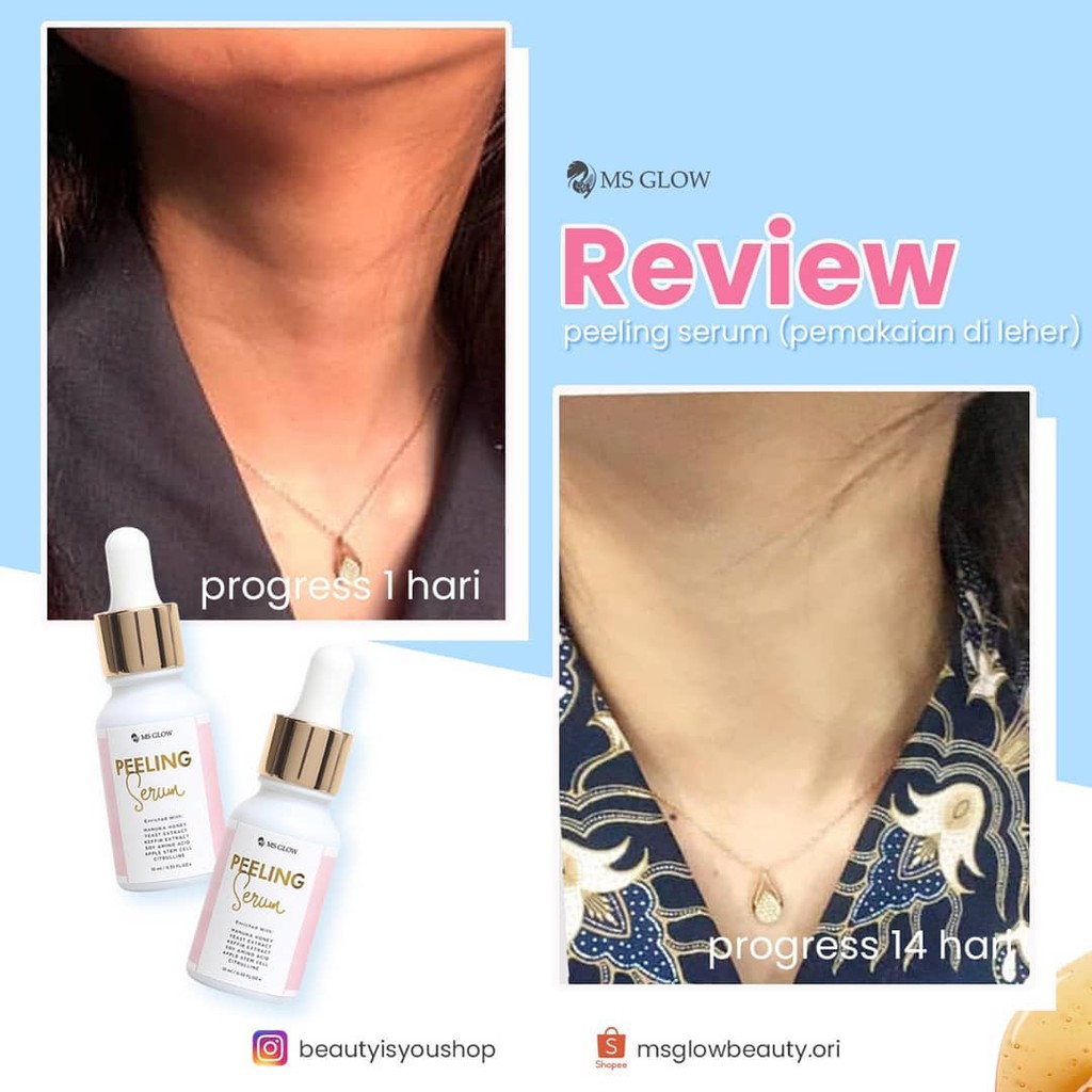 serum peeling