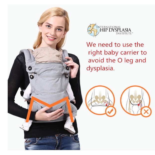 baby carriers and hip dysplasia