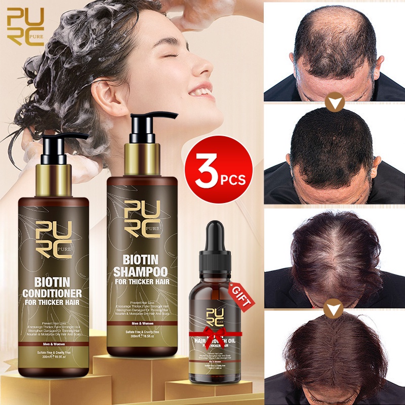 Ginger Hair Growth Hair Thickening Hair Loss Treatments Shampoo 250ml – B&G  | 3pcs Hair Boost Ginger Cream, Anti-hair Loss Conditioner,ginger Hair  Growth Ointment For Men Women Hair Loss Treatment 