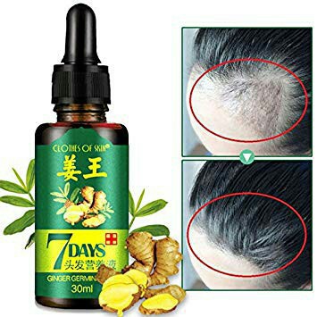 Buy Ginger Germinal Oil Hair Tonic Growth By Clothes Of Skin Essence Serum Minyak Rambut Lebatkan Rambut Seetracker Malaysia