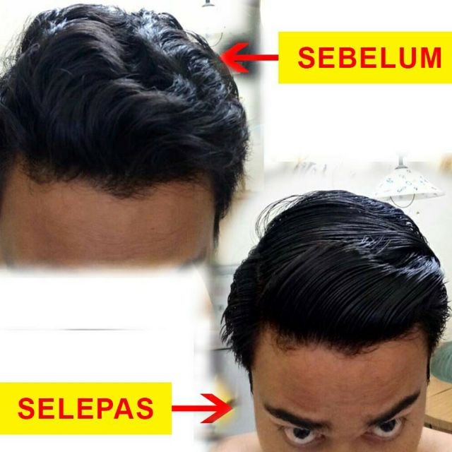 Original Hq 3 In 1 Iavoo Elite Straight Pelurus Rambut Murah Jimat Dan Selamat Shopee Malaysia