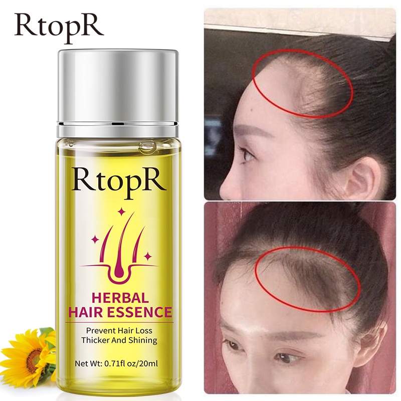 RtopR Herbal Hair Growth Essential Oil Hair Tonic Growth Anti-Hair Loss Hair Help Follicle Growth Improves Dry and Knotted Hair 20ml