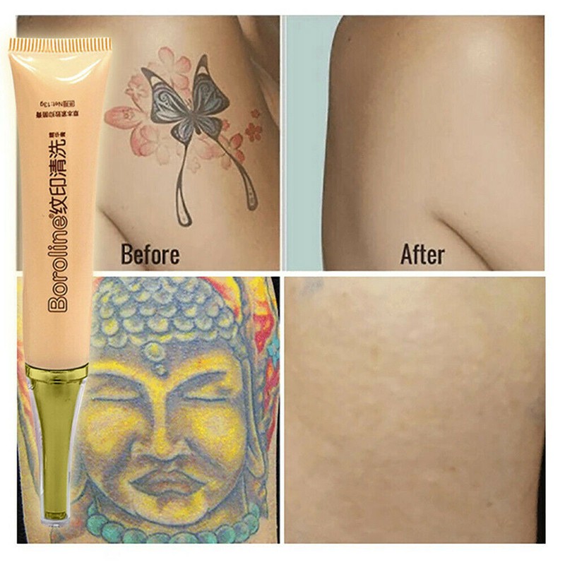 ☜ Boroline Practical Permanent Tattoo Removal Cream No Need For Pain Removal  Maximum Strength ☞SA3C | Shopee Malaysia