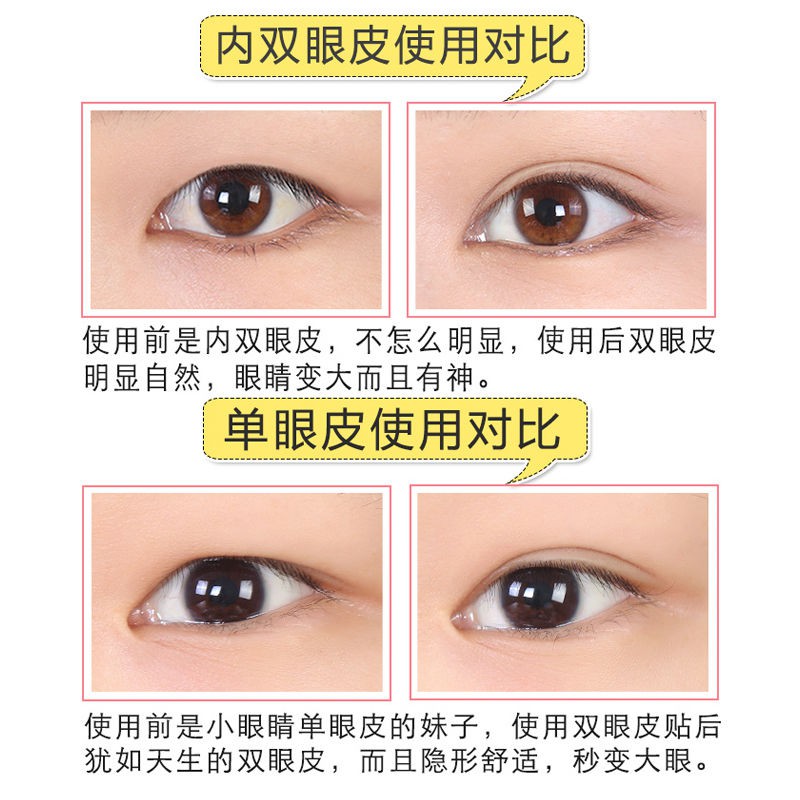 Stick double-fold eyelid Stick double-fold eyelidFlesh color non ...