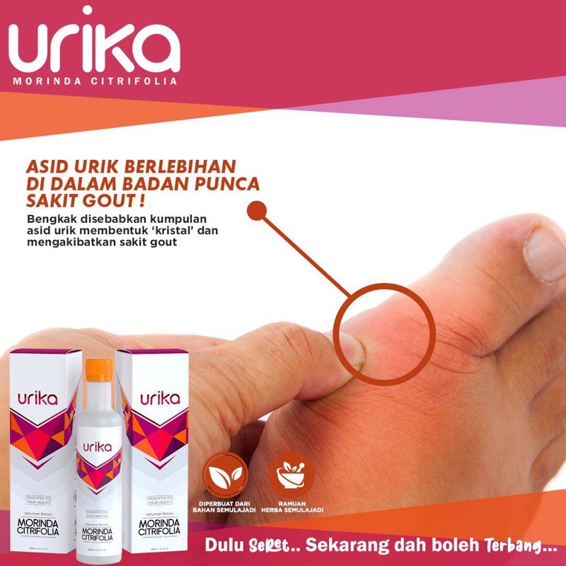 Mencegah Sakit Gout Dengan Mengurangkan Asid Urik Dalam Badan Anda