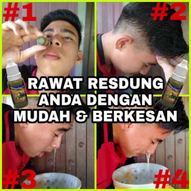 Resdung Herba Keluarkan Lendir Sinus/Gatal/Alergi/Hidung 