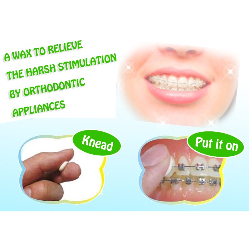 Ready Stock Orthodontic Braces Ortho Relief Wax Shopee Malaysia