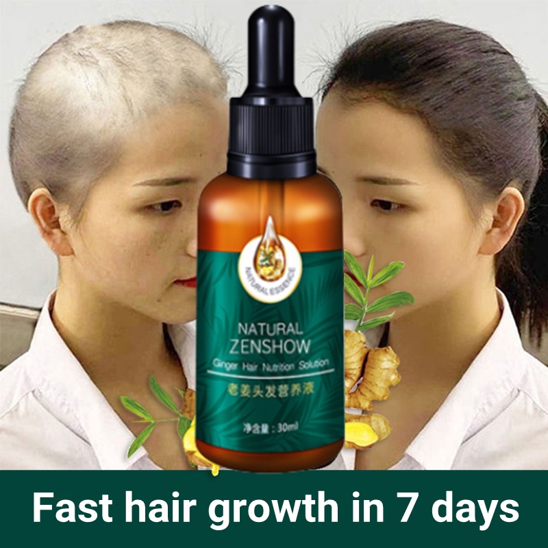 Hair Growth Serum Ginger Essential Oil Nourishing Anti Hair Loss Hair Fall  Rescue tonic rambut gugur 护发精油 生发 防脱发 | Shopee Malaysia