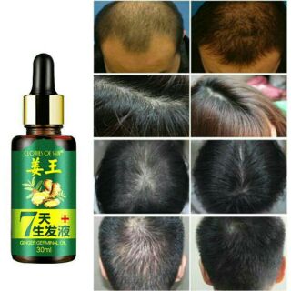 UBAT KUTU RAMBUT (60ml) - A lices lotion menghapuskan kutu 