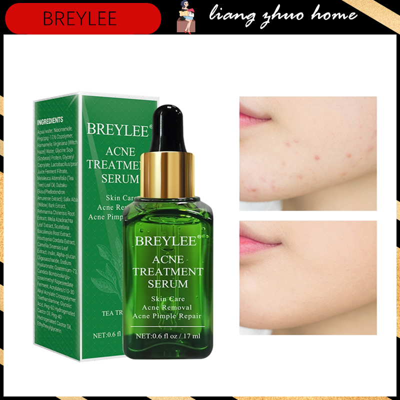 [Ready Stock] BREYLEE Acne Treatment Serum Face Essence Anti Acne Scar