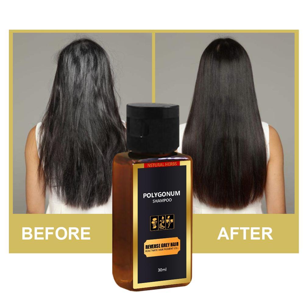 30ml Black Hair Shampoo Grey Reverse Hair Color Shampoo Anti Gray Hair Treatment White Removal Natural Herbal Hair Dye Care Shopee Malaysia