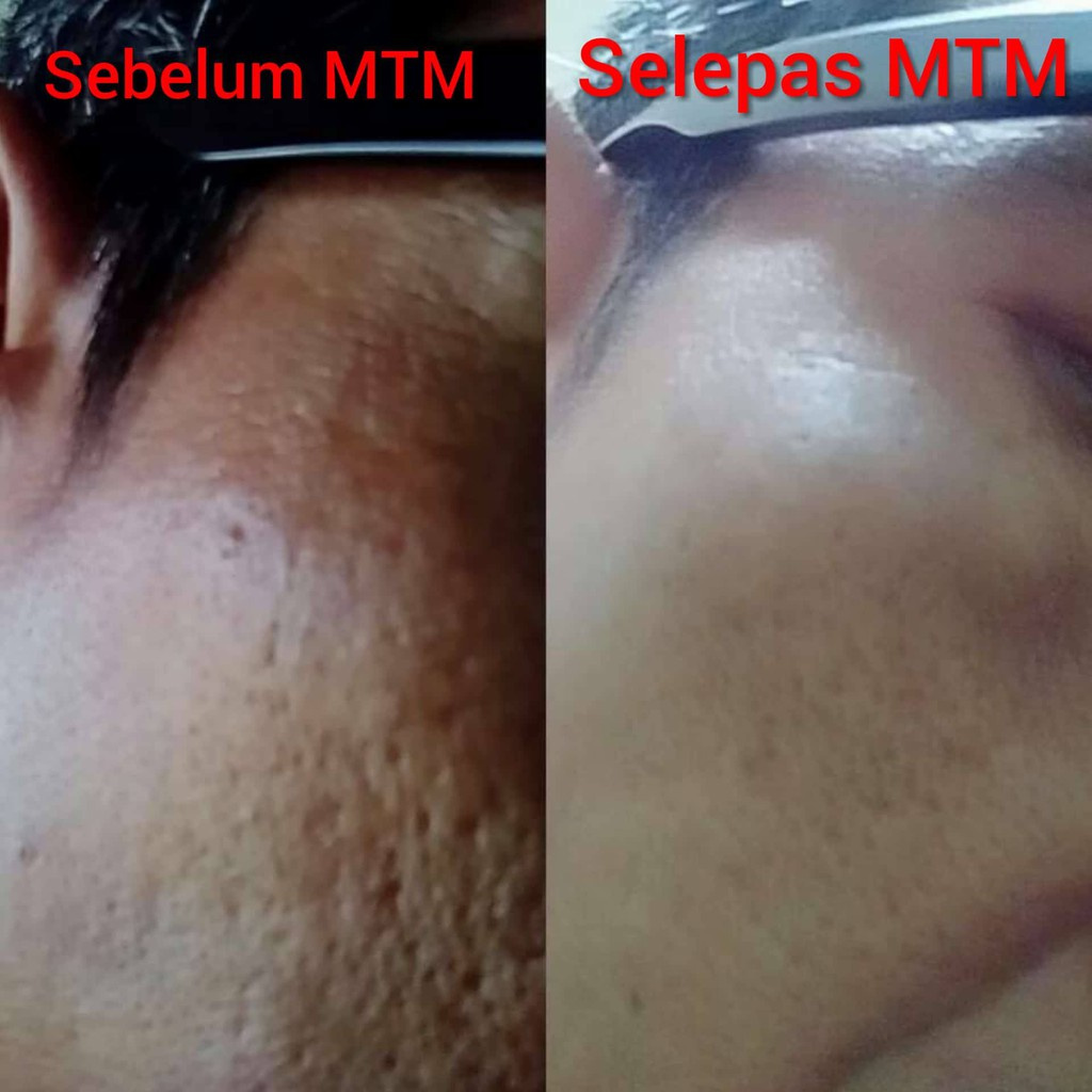Ready Stock Mask Magic Tamarind Mask Merawat Kulit Wajah Masker Mask Face Whitehead Muka Remover Glow Men Women Parut Je