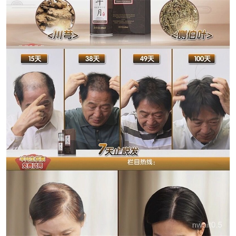 Hair care Prevent hair lossTV Costume Half Moon Hair Growth Hormone Hair  Growth Tonic Hair Growth Liquid Anti-Hair Los | Shopee Malaysia