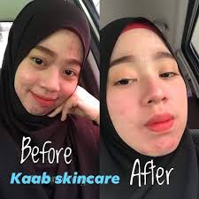 Buy Ka Ab Skincare Serum Balancing Rosehip 50ml Seetracker Malaysia