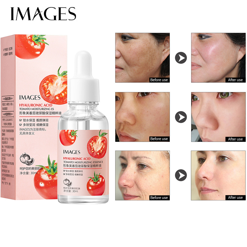 Images Tomato Collagen Serum Essence Hyaluronic Acid Hydrating Facial Essence Moisturizing Replenishing Serum Muka Moisture Skincare 30ml