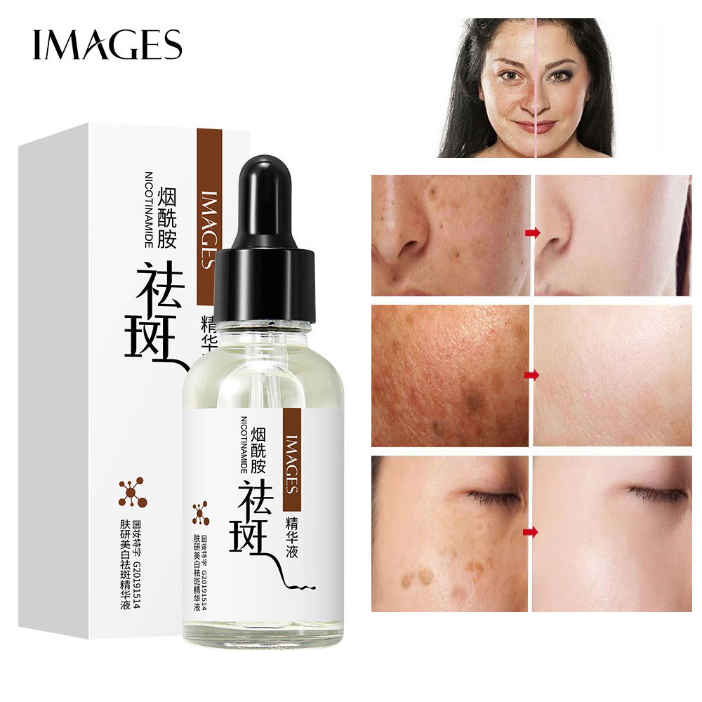 Images Anti Freckles Whitening Serum Muka Hydrating Facial Essence Moisturizer Hymeys Niacinamide Serum Jeragat Melasma Dark Spots Pigmention Remover Freckle Skin Lightening Firming Moisturizing SkinCare 30ml