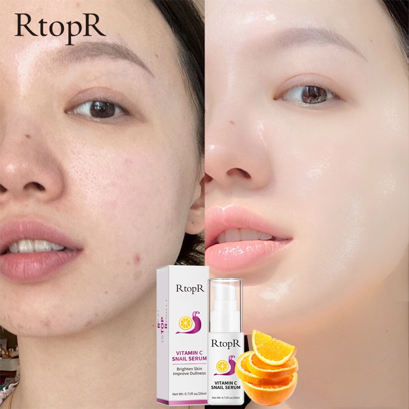 RtopR Vitamin C Whitening Moisturizing Serum Hyaluronic Acid Rejuvenation Anti Wrinkle Firming Bright Skin Serum 20ml