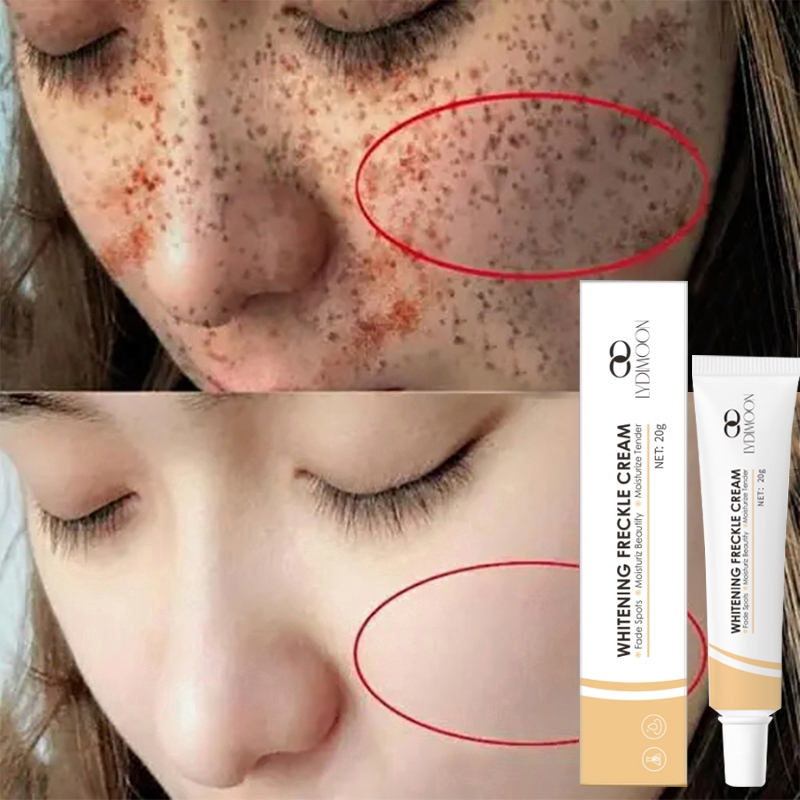 Whitening Facial Moisturizer Original whitening freckle cream Dark Spot Cream Acne Mark Freckle Cream 20g 清除雀斑黄褐斑