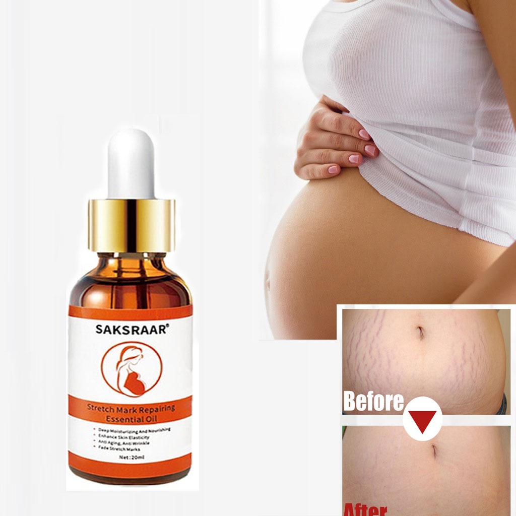 Stretch Marks Remover Essential Oil Skin Care Treatment Cream for Stretch Mark Removal Maternity Slackline for Pregnant Oils