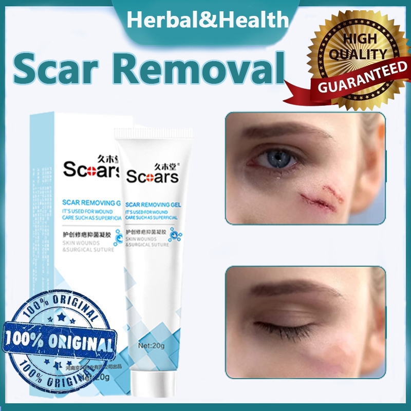 Scar Removal Cream Obat Atasi Keloid Hyperplasia Scar Repair Gel Stretch Marks Burns Parut Treatment 祛疤膏 20g