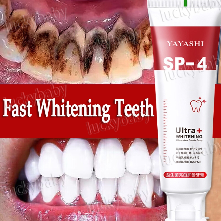 SP-4 Whitening Toothpaste Probiotic Caries Toothpaste for Bad Breath Stain Removal for Maintain Oral Health 120g