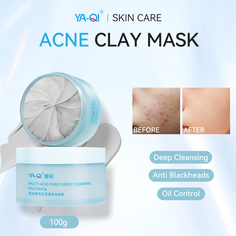 YA-QI Acne Clay Mask 100g Masker Muka Amazon White Mud Mask Muka Anti Pores Reduce Redness Skincare Blackhead Remover Oil Control Acne Facial Mask