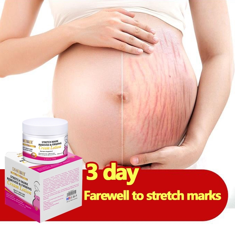 Stretch mark cream DR•MEINAIER®Stretch mark lotion Beauty skin care Wrinkle-resistant Removes wrinkle marks stretch mark oil Skincare products for pregnant women150g