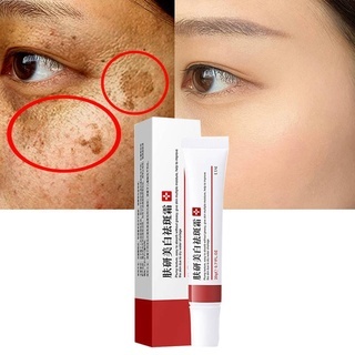 Whitening Freckle Cream Remove Melasma Cream Remove Dark Spots Melanin Melasma Remover Brighten Skin Anti-Aging Skin Lightening