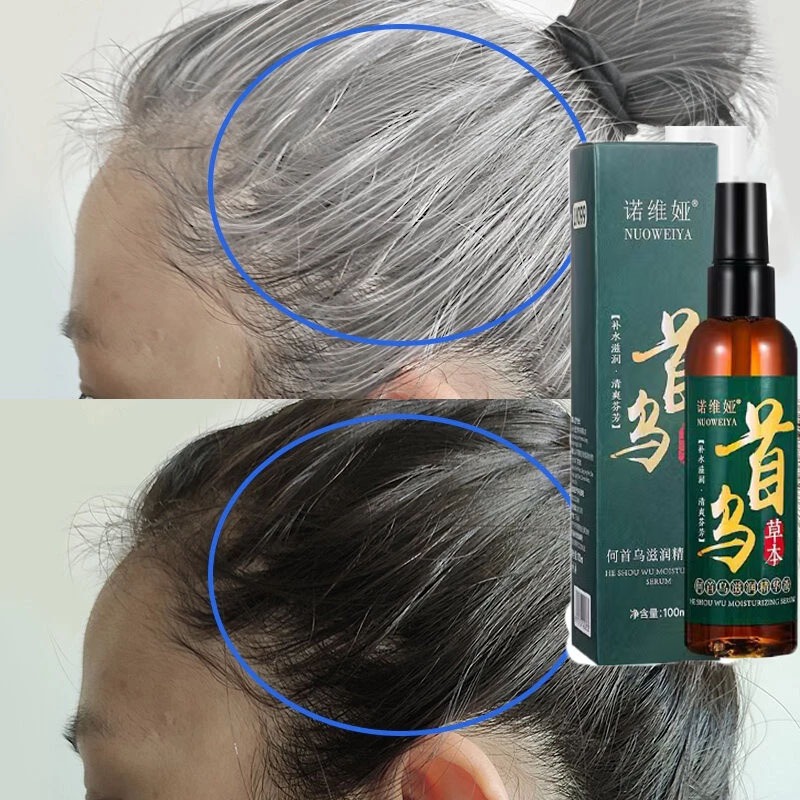【100%ORI】Herbs Hair Growth Serum Black Hair Growth Spray 100ml White Hair Turning Black Hair Anti Hair Loss Care Essence Spray Fast Growth Ubat Rambut Gugur lelaki Treatment 何首乌生发液