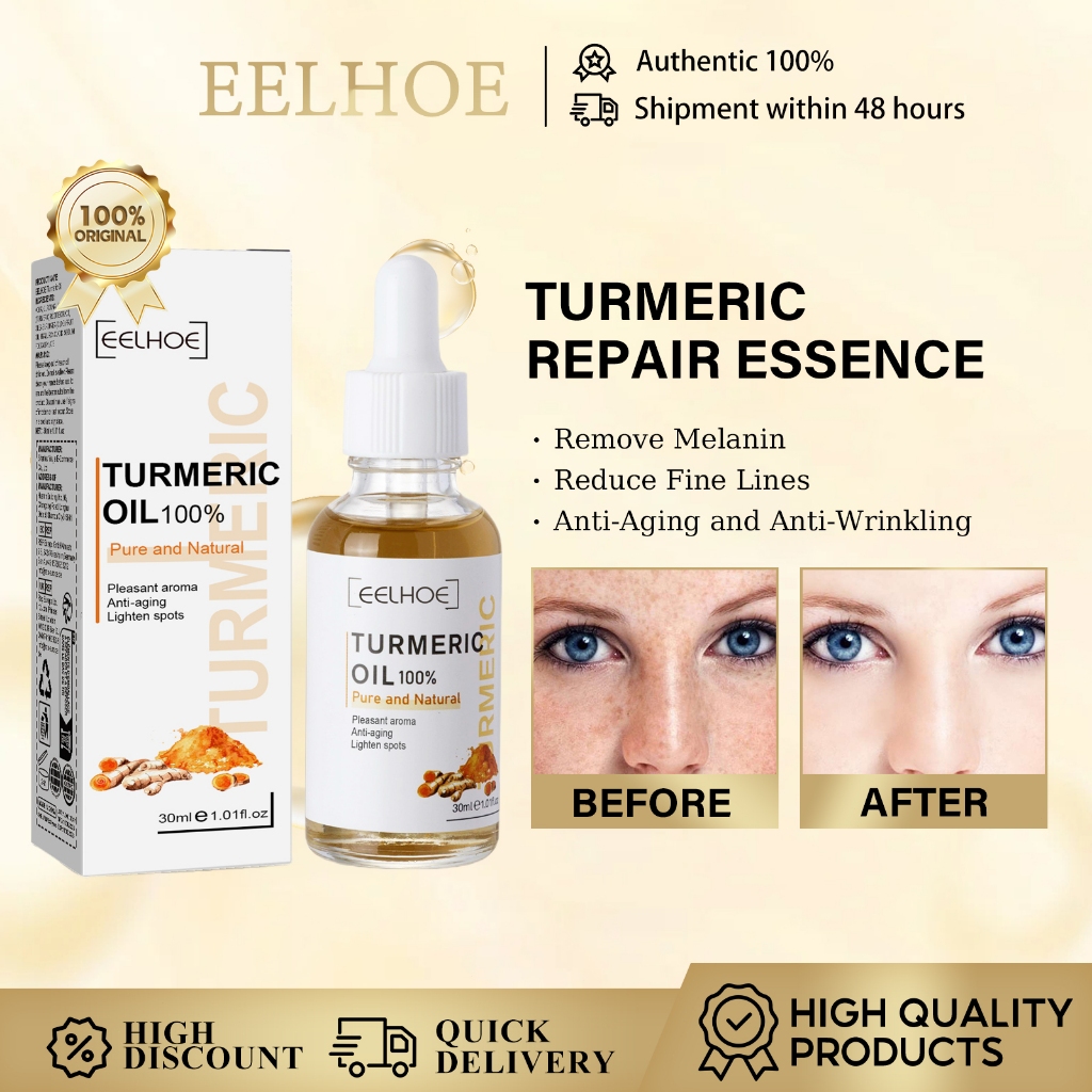 Eelhoe Turmeric Correction Essence Turmeric Spot Lightening Essence Turmeric Repair Essence Turmeric Whitening Serum Face Whitening Essence Remove Melanin Reduce Fine Lines