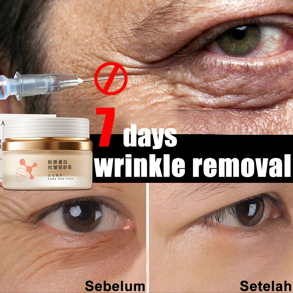 anti wrinkle cream Qingling Wrinkle Removal Cream retinol cream anti aging cream 50g Effecive Anti-aging Remove wrinkles Whitening Repair Lift and firm skin Moisturizing