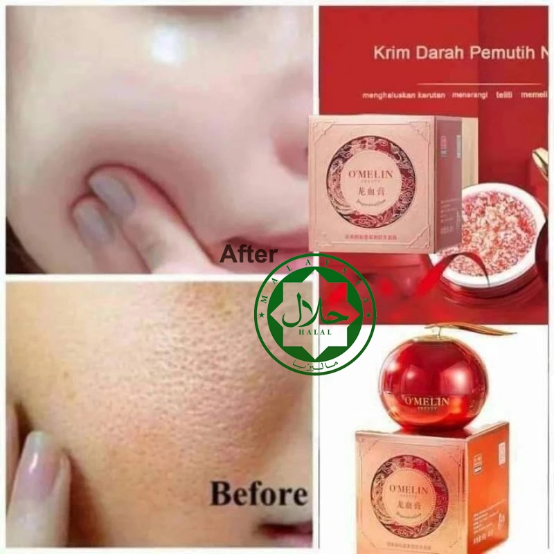 Hot Selling O'MELIN Dragon’s Blood Cream Noble Lady Fair Cream Anti-Aging Anti-Wrinkle Moisturize