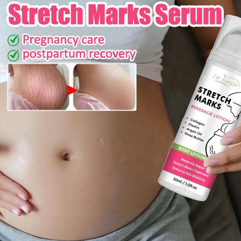 Dr Jungle Anti Stretch Mark Cream | Safe for Pregnancy & Postpartum | Smooth & Firm Skin ??