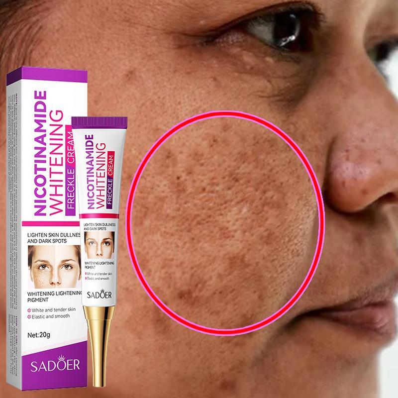 【Buy 2 get 1 free】Niacinamide Whitening Cream Freckle Removal Dark Spots Remover Brightening Skin Moisturising Removing Acne marks Facial blemishes