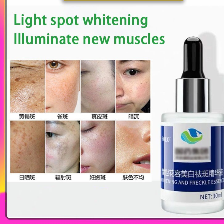 Whitening, freckle removing and spot lightening essence to improve facial dullness essence美白祛斑淡斑精华液改善面部暗沉