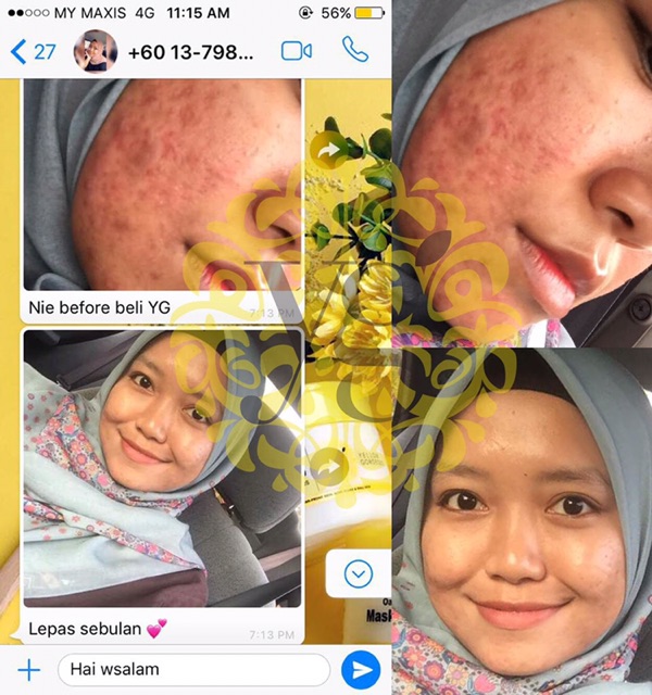 Ready Stock Yello Skincare Oatmeal Turmeric Face Mask Scrub Snowmeric Brightening Serum Trial Shopee Malaysia